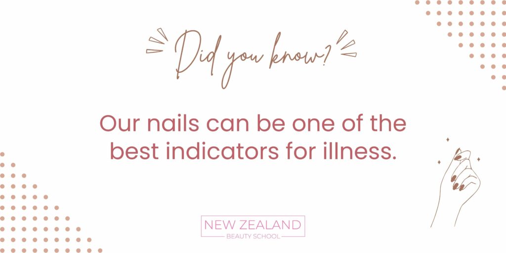 Nails can be a indicator for illness infographic