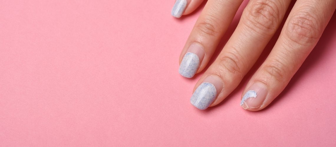 Cracked,Broken,Nail,,Nail,Weakness,Damage,From,Gel,Polish,Coating,